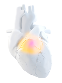 white 3D render of heart with orange shading in the center indicating inflammation.