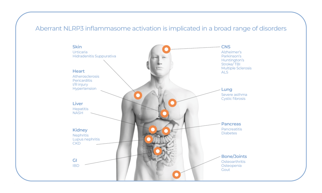 3D render of human body with orange dots pointing to major organs and related disorders associated with NLRP3 inflammasome activation.